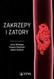 Zakrzepy i zatory. Autor: Pasierski Tomasz. Dadada.pl Okładka książki Zakrzepy i zatory