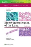 Okładka książki Biopsy Interpretation of the Lung
