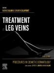 Okładka książki Treatment of Leg Veins